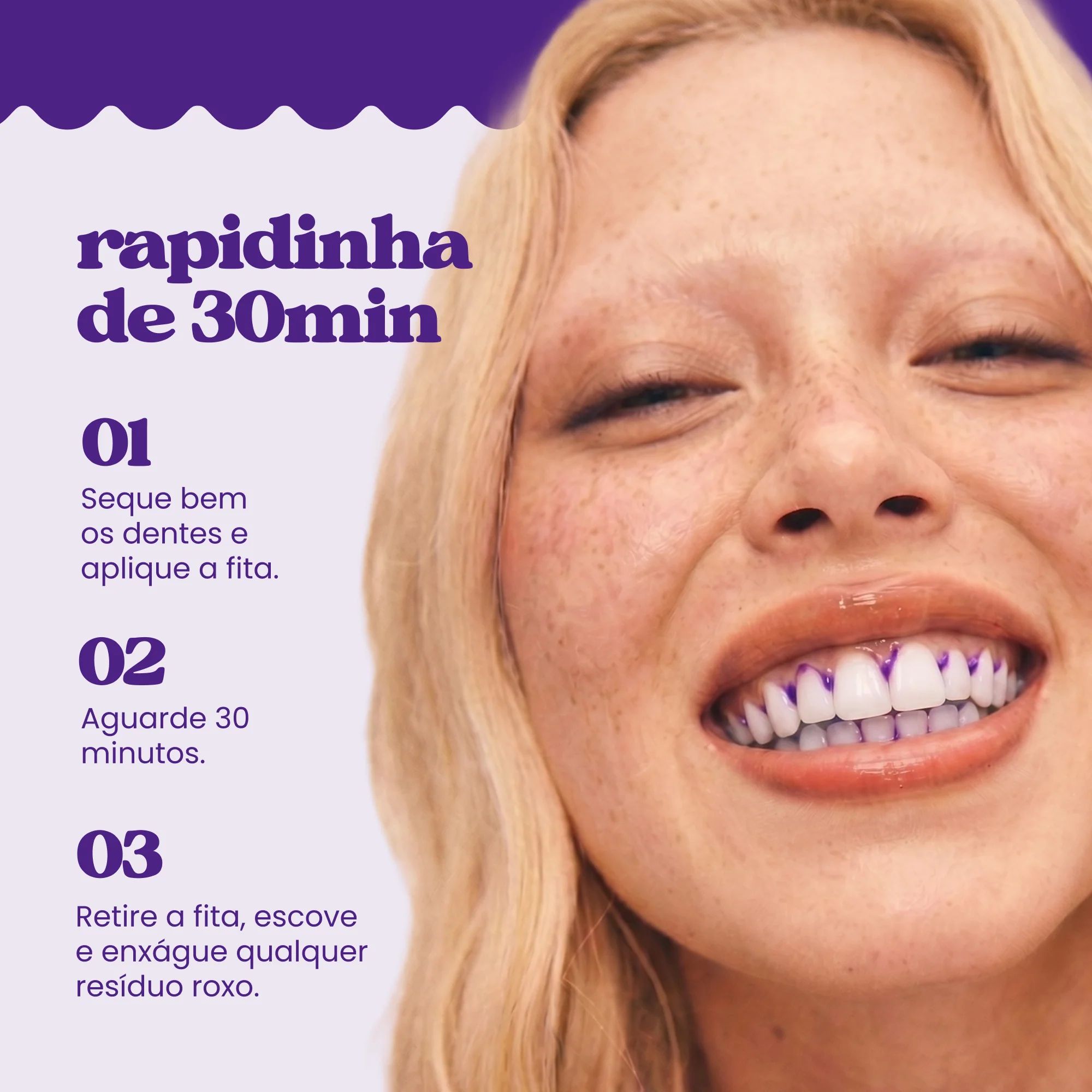 Fita Clareadora Roxa RX3 - imagem 5